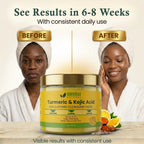 AMVital Turmeric Kojic Acid Cleansing Pads