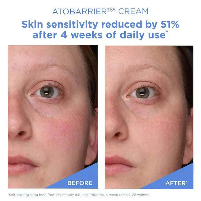AESTURA Travel Size ATOBARRIER365 Cream Moisturizer 30ml | Ceramide Barrier Repair Cream